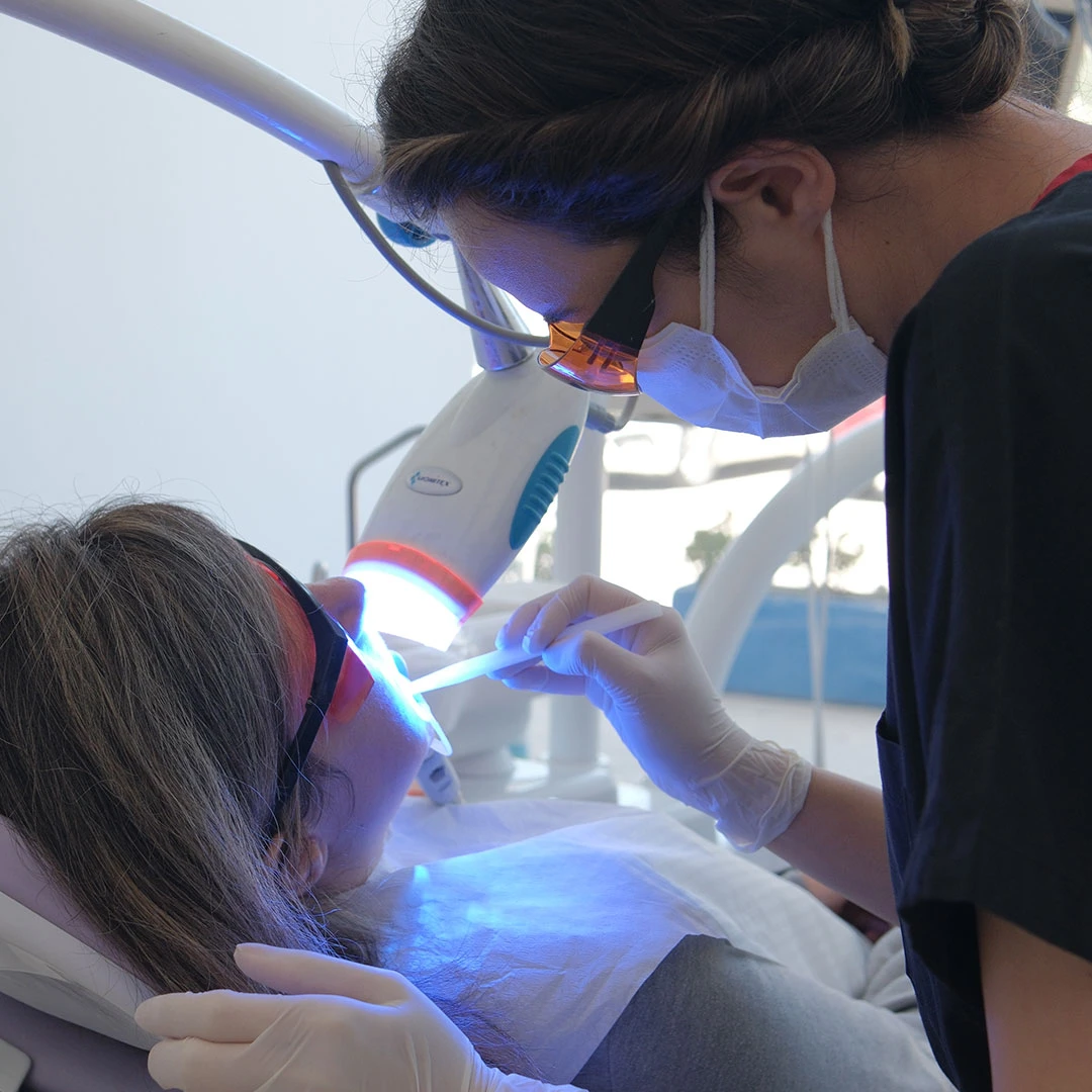 Why Should You Get Teeth Whitening Treatment?