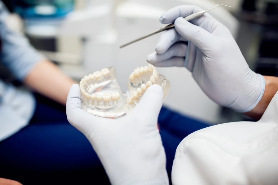 Why Should You Get a Dental Bridge Treatment?