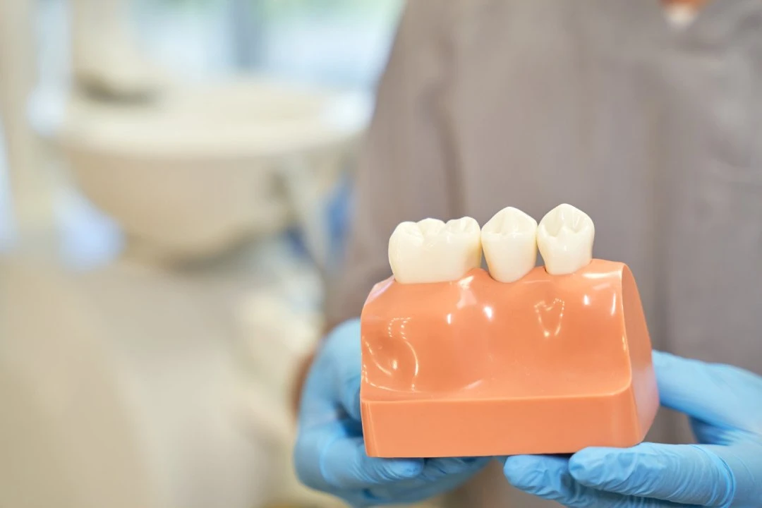Why Should You Get Dental Crown Treatment?