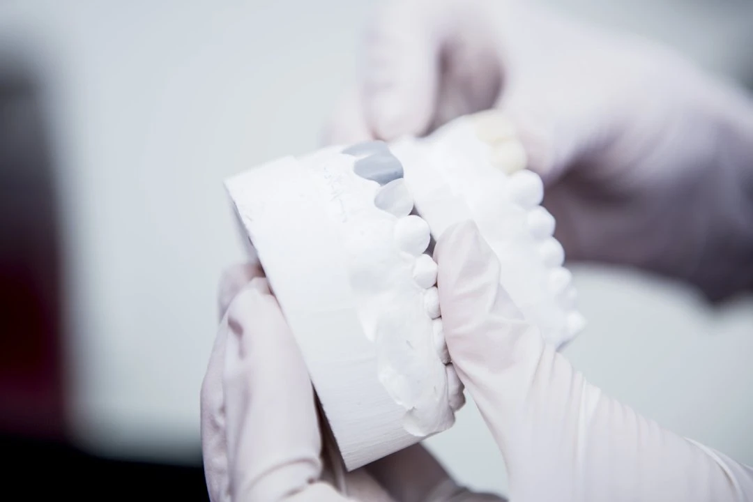 Why Should You Get Composite Bonding?